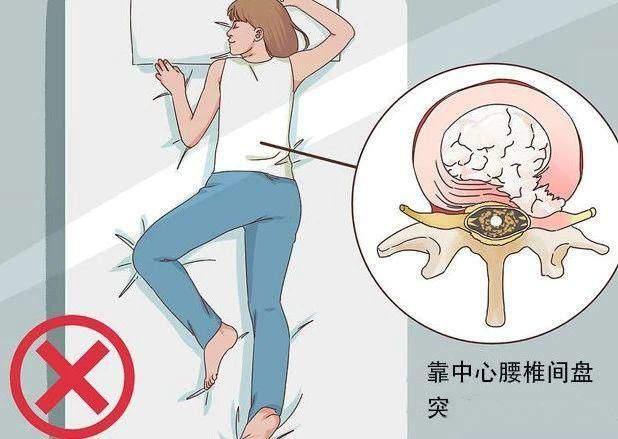 揭秘专家眼中最伤腰的睡姿，你的睡眠姿势正确吗？